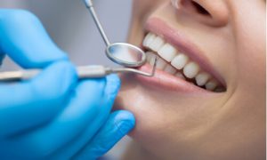 kinds of dental crown problems