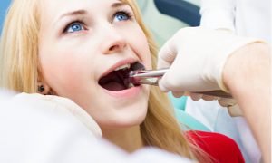 how wisdom tooth extraction