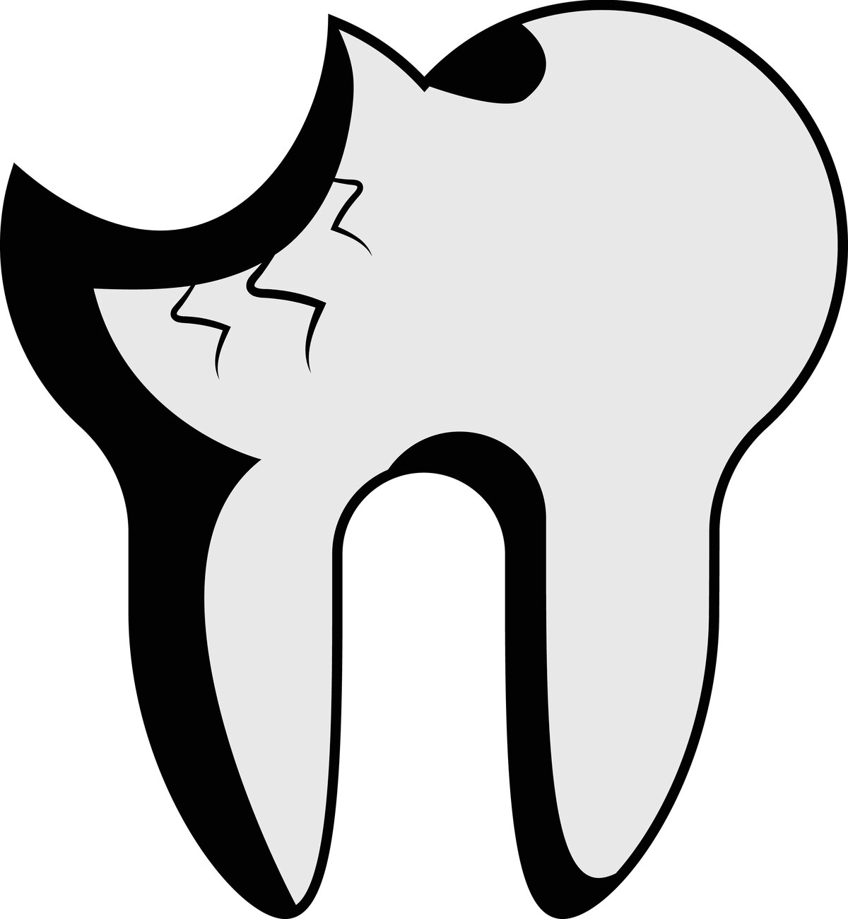 Cracked Tooth Symptoms Causes, Diagnosis, and Treatment