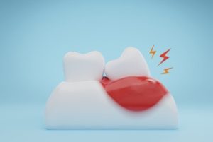 tooth nerve pain causes