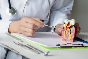 tooth broken root still in gums decay