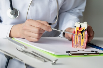 Tooth Broken Root Still in Gums: Steps for Relief and Care