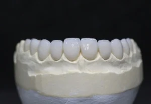 Tooth Crown Pain set